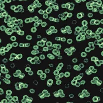 Ковролин Flotex Sottsass Bacteria 990102 Ковролин Flotex Sottsass Bacteria 990102