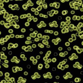 Ковролин Flotex Sottsass Bacteria 990103 Ковролин Flotex Sottsass Bacteria 990103