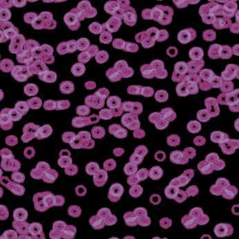 Ковролин Flotex Sottsass Bacteria 990104
