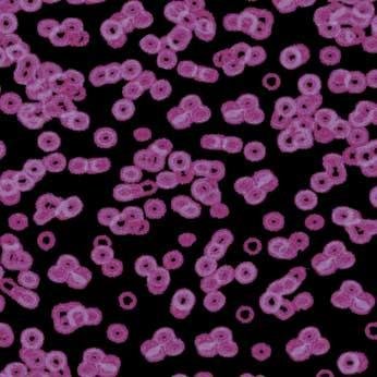 Ковролин Flotex Sottsass Bacteria 990104 Ковролин Flotex Sottsass Bacteria 990104