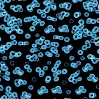 Ковролин Flotex Sottsass Bacteria 990105 Ковролин Flotex Sottsass Bacteria 990105