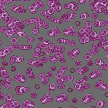 Ковролин Flotex Sottsass Bacteria 990301 Ковролин Flotex Sottsass Bacteria 990301