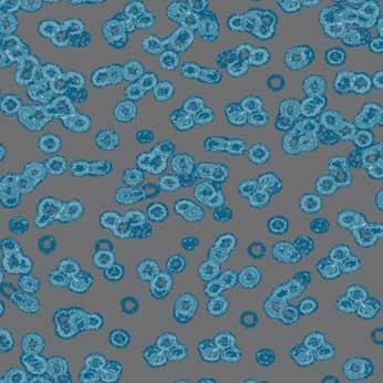 Ковролин Flotex Sottsass Bacteria 990303 Ковролин Flotex Sottsass Bacteria 990303