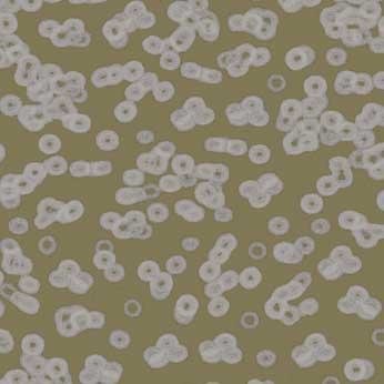 Ковролин Flotex Sottsass Bacteria 990401 Ковролин Flotex Sottsass Bacteria 990401